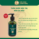 Thảo dược đặc trị nấm da đầu